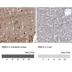 Anti-NBEA Antibody