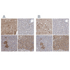 Immunohistochemical staining of human cerebral cortex, liver, pancreas and stomach using Anti-NBEA antibody HPA040385 (A) shows similar protein distribution across tissues to independent antibody HPA039730 (B).