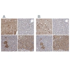 Immunohistochemical staining of human cerebral cortex, liver, pancreas and stomach using Anti-NBEA antibody HPA040385 (A) shows similar protein distribution across tissues to independent antibody HPA039730 (B).