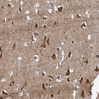 Immunohistochemical staining of human cerebral cortex shows strong cytoplasmic positivity in neurons.