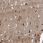Immunohistochemical staining of human cerebral cortex shows strong cytoplasmic positivity in neurons.