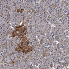 Immunohistochemical staining of human pancreas shows strong cytoplasmic positivity in islets of Langerhans.