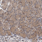 Immunohistochemical staining of human stomach shows moderate cytoplasmic positivity in glandular cells.