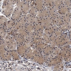 Immunohistochemical staining of human stomach shows moderate cytoplasmic positivity in glandular cells.