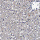 Immunohistochemical staining of human liver shows no positivity in hepatocytes as expected.