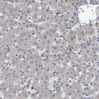 Immunohistochemical staining of human liver shows no positivity in hepatocytes as expected.