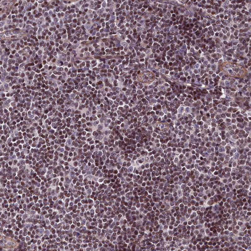 Anti-SP4 Antibody