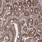 Immunohistochemical staining of human small intestine shows strong nuclear positivity in glandular cells.