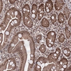 Immunohistochemical staining of human small intestine shows strong nuclear positivity in glandular cells.