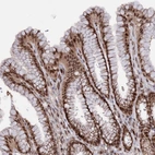 Immunohistochemical staining of human stomach shows strong nuclear positivity in glandular cells.
