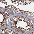 Immunohistochemical staining of human testis shows strong nuclear positivity in cells in seminiferous ducts.