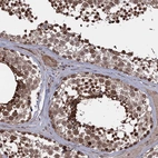 Immunohistochemical staining of human testis shows strong nuclear positivity in cells in seminiferous ducts.