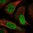 Immunofluorescent staining of human cell line U-2 OS shows localization to nucleoplasm & vesicles.