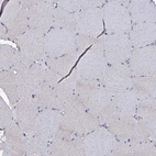 Immunohistochemical staining of human skeletal muscle shows low expression as expected.