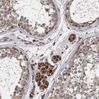 Anti-CNNM1 Antibody