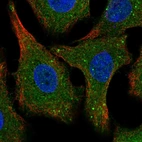 Immunofluorescent staining of human cell line A549 shows localization to cytosol & vesicles.