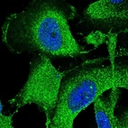 Immunofluorescent staining of human cell line U-251 MG shows localization to plasma membrane & cytosol.