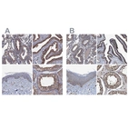 Immunohistochemical staining of human endometrium, fallopian tube, skin and testis using Anti-NEK1 antibody HPA040413 (A) shows similar protein distribution across tissues to independent antibody HPA020873 (B).