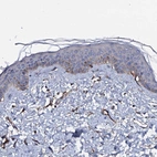 Immunohistochemical staining of human skin shows weak cytoplasmic positivity in squamous epithelial cells as expected.