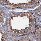 Immunohistochemical staining of human testis shows strong cytoplasmic positivity in cells in seminiferous ducts.