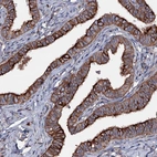 Immunohistochemical staining of human Fallopian tube shows strong cytoplasmic/ membranous positivity in glandular cells.