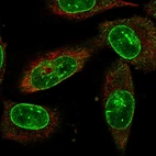 Immunofluorescent staining of human cell line U-251 MG shows localization to nuclear membrane.