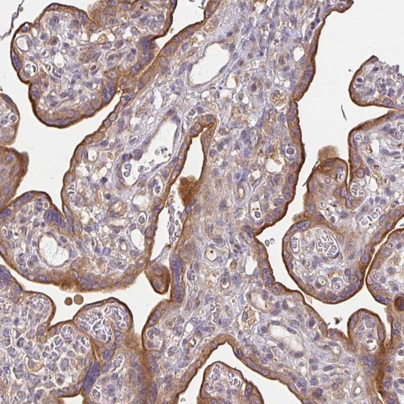 Anti-EEF1AKMT1 Antibody