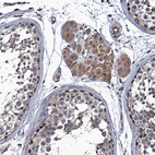 Immunohistochemical staining of human testis shows moderate cytoplasmic positivity in Leydig cells.