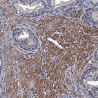 Immunohistochemical staining of human prostate shows moderate cytoplasmic positivity in smooth muscle cells.
