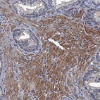 Immunohistochemical staining of human prostate shows moderate cytoplasmic positivity in smooth muscle cells.