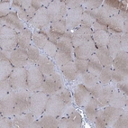 Immunohistochemical staining of human skeletal muscle shows weak cytoplasmic positivity in myocytes.