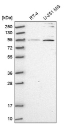 Western blot analysis in human cell line RT-4 and human cell line U-251 MG.