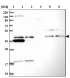 Lane 1: Marker [kDa] 250, 130, 95, 72, 55, 36, 28, 17, 10_br/_Lane 2: Human cell line RT-4_br/_Lane 3: Human cell line U-251MG sp_br/_Lane 4: Human plasma (IgG/HSA depleted)_br/_Lane 5: Human liver tissue_br/_Lane 6: Human tonsil tissue
