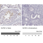 Anti-NUTM1 Antibody
