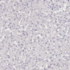 Immunohistochemical staining of human liver shows no positivity in hepatocytes as expected.