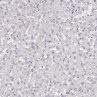 Immunohistochemical staining of human liver shows no positivity in hepatocytes as expected.