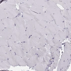 Immunohistochemical staining of human skeletal muscle shows no positivity in myocytes as expected.