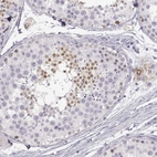 Immunohistochemical staining of human testis shows weak to moderate nuclear positivity in a subset of cells in seminiferous ducts.