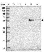 Lane 1: Marker [kDa] 250, 130, 95, 72, 55, 36, 28, 17, 10_br/_Lane 2: Human cell line RT-4_br/_Lane 3: Human cell line U-251MG sp_br/_Lane 4: Human plasma (IgG/HSA depleted)_br/_Lane 5: Human liver tissue_br/_Lane 6: Human tonsil tissue