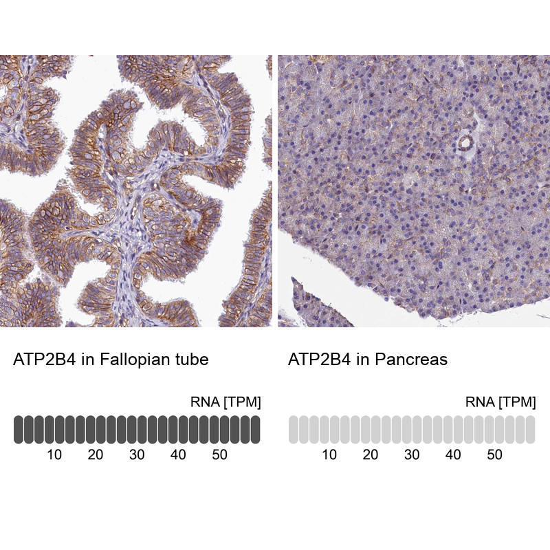 Anti-ATP2B4 Antibody
