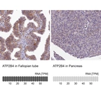 Anti-ATP2B4 Antibody