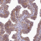 Immunohistochemical staining of human fallopian tube shows high expression.