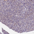 Immunohistochemical staining of human pancreas shows low expression as expected.