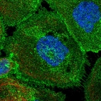 Immunofluorescent staining of human cell line A-431 shows localization to plasma membrane.