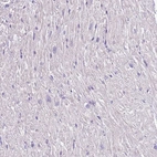 Immunohistochemical staining of human heart muscle shows no positivity in cardiomyocytes.