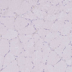 Immunohistochemical staining of human skeletal muscle shows no positivity in myocytes.
