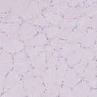 Immunohistochemical staining of human skeletal muscle shows no positivity in myocytes.