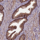 Immunohistochemical staining of human prostate shows strong granular cytoplasmic positivity in glandular cells.