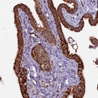 Immunohistochemical staining of human Fallopian tube shows strong granular cytoplasmic positivity in glandular cells.