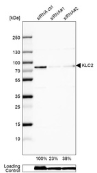 Western blot analysis in U-138MG cells transfected with control siRNA, target specific siRNA probe #1 and #2, using Anti-KLC2 antibody. Remaining relative intensity is presented. Loading control: Anti-GAPDH.
